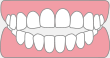 前歯がうまく閉じられない